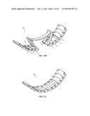 SEGMENTED ATTACHMENT DEVICE diagram and image