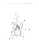 HAIR WASHING SUPPORT DEVICE diagram and image