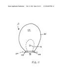 Closing Mechanism for Toilet diagram and image