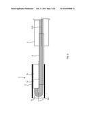 ENDOSCOPE diagram and image