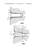 Anoscope diagram and image