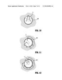 Anoscope diagram and image