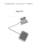 SENSORS, INCLUDING DISPOSABLE SENSORS, FOR MEASURING TISSUE diagram and image