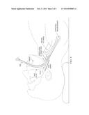 DEVICES FOR DIAGNOSING SLEEP APNEA OR OTHER CONDITIONS AND RELATED SYSTEMS     AND METHODS diagram and image