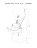 DEVICES FOR DIAGNOSING SLEEP APNEA OR OTHER CONDITIONS AND RELATED SYSTEMS     AND METHODS diagram and image