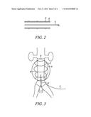 DEVICE FOR MEASUREMENT OF PRESSURE AND FOR ADMINISTRATION OF DRUGS TO AN     ANEURYSM IN A BLOOD VESSEL diagram and image