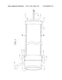 TRANS-SEPTAL SHEATH WITH SPLITTING DILATING NEEDLE AND METHOD FOR ITS USE diagram and image