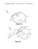 BALLOON ASSEMBLY FOR USE IN A HEMOSTASIS BAND diagram and image