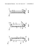 MINIMALLY INVASIVE RETRACTOR AND METHODS OF USE diagram and image