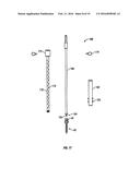 MINIMALLY INVASIVE RETRACTOR AND METHODS OF USE diagram and image