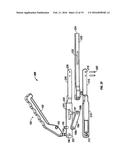 MINIMALLY INVASIVE RETRACTOR AND METHODS OF USE diagram and image