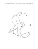 MINIMALLY INVASIVE RETRACTOR AND METHODS OF USE diagram and image