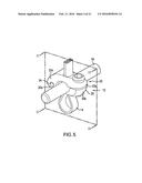 BONE FIXATION TENSIONING TOOL AND METHOD diagram and image