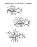 BONE FIXATION TENSIONING TOOL AND METHOD diagram and image