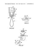 BONE FIXATION TENSIONING TOOL AND METHOD diagram and image