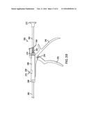 BONE FIXATION TENSIONING TOOL AND METHOD diagram and image