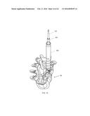 RETRACTION DEVICES, SYSTEMS, AND METHODS FOR MINIMALLY INVASIVE SPINAL     SURGERY diagram and image