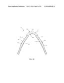 MANDIBULAR BONE PLATE diagram and image