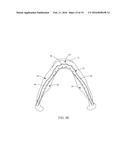 MANDIBULAR BONE PLATE diagram and image