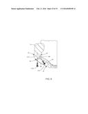 MANDIBULAR BONE PLATE diagram and image