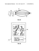 DEVICES AND METHODS FOR TRACKING AN ENERGY DELIVERY DEVICE diagram and image