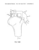 METHOD FOR CREATING A CUSTOMIZED ARTHROPLASTY RESECTION GUIDE UTILIZING     TWO-DIMENSIONAL IMAGING diagram and image