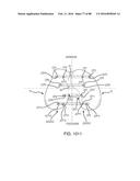 METHOD FOR CREATING A CUSTOMIZED ARTHROPLASTY RESECTION GUIDE UTILIZING     TWO-DIMENSIONAL IMAGING diagram and image