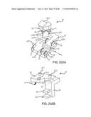 METHOD FOR CREATING A CUSTOMIZED ARTHROPLASTY RESECTION GUIDE UTILIZING     TWO-DIMENSIONAL IMAGING diagram and image