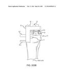 METHOD FOR CREATING A CUSTOMIZED ARTHROPLASTY RESECTION GUIDE UTILIZING     TWO-DIMENSIONAL IMAGING diagram and image