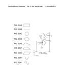 METHOD FOR CREATING A CUSTOMIZED ARTHROPLASTY RESECTION GUIDE UTILIZING     TWO-DIMENSIONAL IMAGING diagram and image