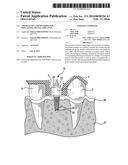 APPARATUSES AND METHODS FOR IMPLANTING DENTAL IMPLANTS diagram and image