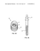 APPARATUSES AND METHODS FOR IMPLANTING DENTAL IMPLANTS diagram and image