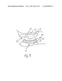 BONE FOUNDATION GUIDE SYSTEM AND METHOD diagram and image