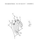 BONE FOUNDATION GUIDE SYSTEM AND METHOD diagram and image