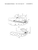 DENTAL APPLIANCE FOR ADJUSTING THE POSITION OF THE LOWER JAW OF A PATIENT     WITH RESPECT TO THE UPPER JAW THEREOF diagram and image
