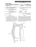 SYSTEMS AND METHODS FOR PROVIDING A STEM ON A TIBIAL COMPONENT diagram and image