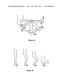 SYSTEMS AND METHODS FOR PROVIDING A STEM ON A TIBIAL COMPONENT diagram and image