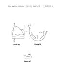 SYSTEMS AND METHODS FOR PROVIDING A STEM ON A TIBIAL COMPONENT diagram and image