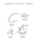 SYSTEMS AND METHODS FOR PROVIDING A STEM ON A TIBIAL COMPONENT diagram and image