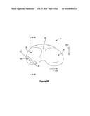 SYSTEMS AND METHODS FOR PROVIDING A STEM ON A TIBIAL COMPONENT diagram and image