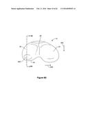 SYSTEMS AND METHODS FOR PROVIDING A STEM ON A TIBIAL COMPONENT diagram and image