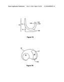 SYSTEMS AND METHODS FOR PROVIDING A STEM ON A TIBIAL COMPONENT diagram and image