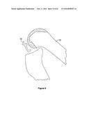 SYSTEMS AND METHODS FOR PROVIDING A STEM ON A TIBIAL COMPONENT diagram and image