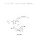 SYSTEMS AND METHODS FOR PROVIDING A STEM ON A TIBIAL COMPONENT diagram and image