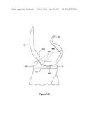 SYSTEMS AND METHODS FOR PROVIDING A STEM ON A TIBIAL COMPONENT diagram and image