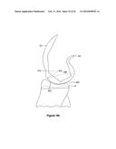 SYSTEMS AND METHODS FOR PROVIDING A STEM ON A TIBIAL COMPONENT diagram and image