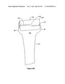 SYSTEMS AND METHODS FOR PROVIDING A STEM ON A TIBIAL COMPONENT diagram and image