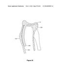 SYSTEMS AND METHODS FOR PROVIDING A STEM ON A TIBIAL COMPONENT diagram and image