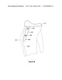 SYSTEMS AND METHODS FOR PROVIDING A STEM ON A TIBIAL COMPONENT diagram and image