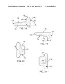 SPINAL INTERVERTEBRAL IMPLANT diagram and image